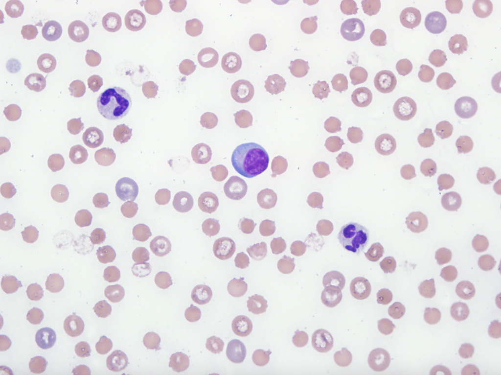 matlab - Segmentation and Labeling of White Blood Cells - Signal Processing Stac